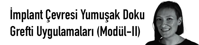 İmplant Çevresi Yumuşak Doku Grefti Uygulamaları (Modül-II)