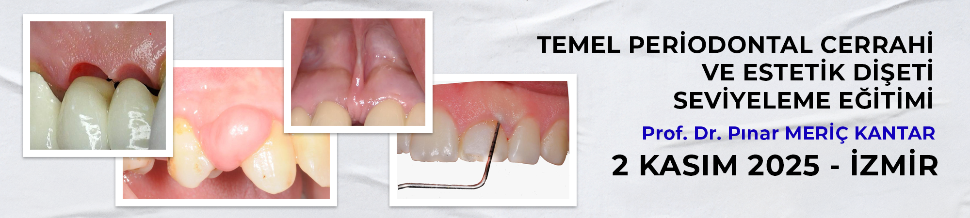 Temel Periodontal Cerrahi ve Estetik Dişeti Seviyeleme Eğitimi